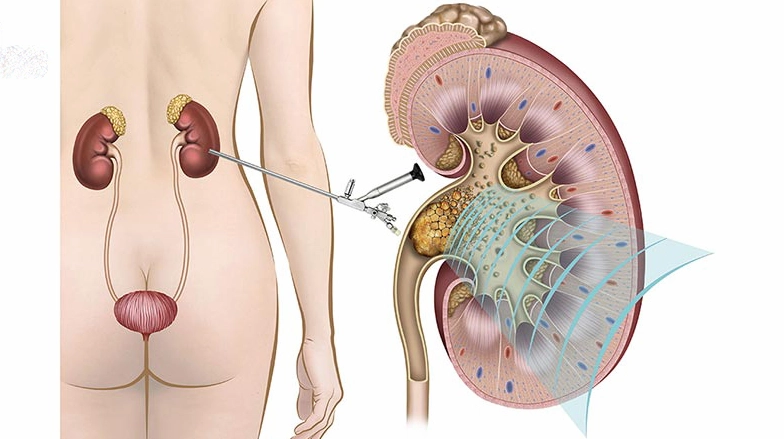 Củ dền là gì? Khám phá lợi ích và cách dùng tốt cho sức khỏe 5 Củ dền đỏ được chế biến thành nhiều món ăn ngon