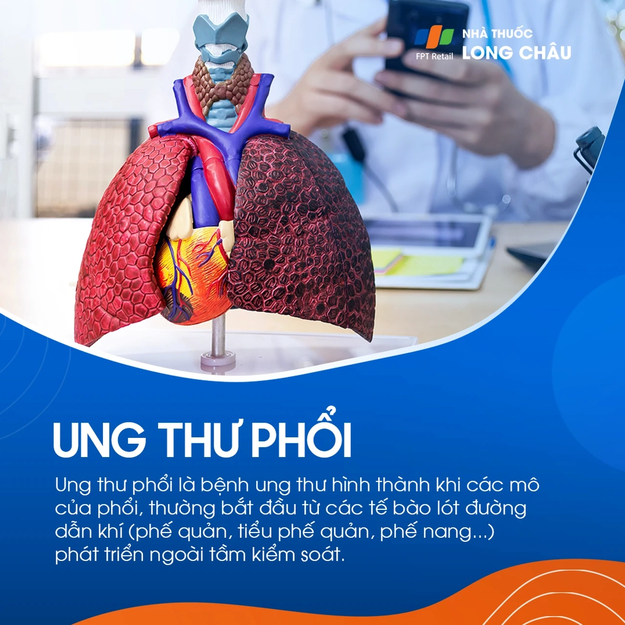 Đồ họa thông tin về các nguyên nhân chính gây ra ung thư phổi